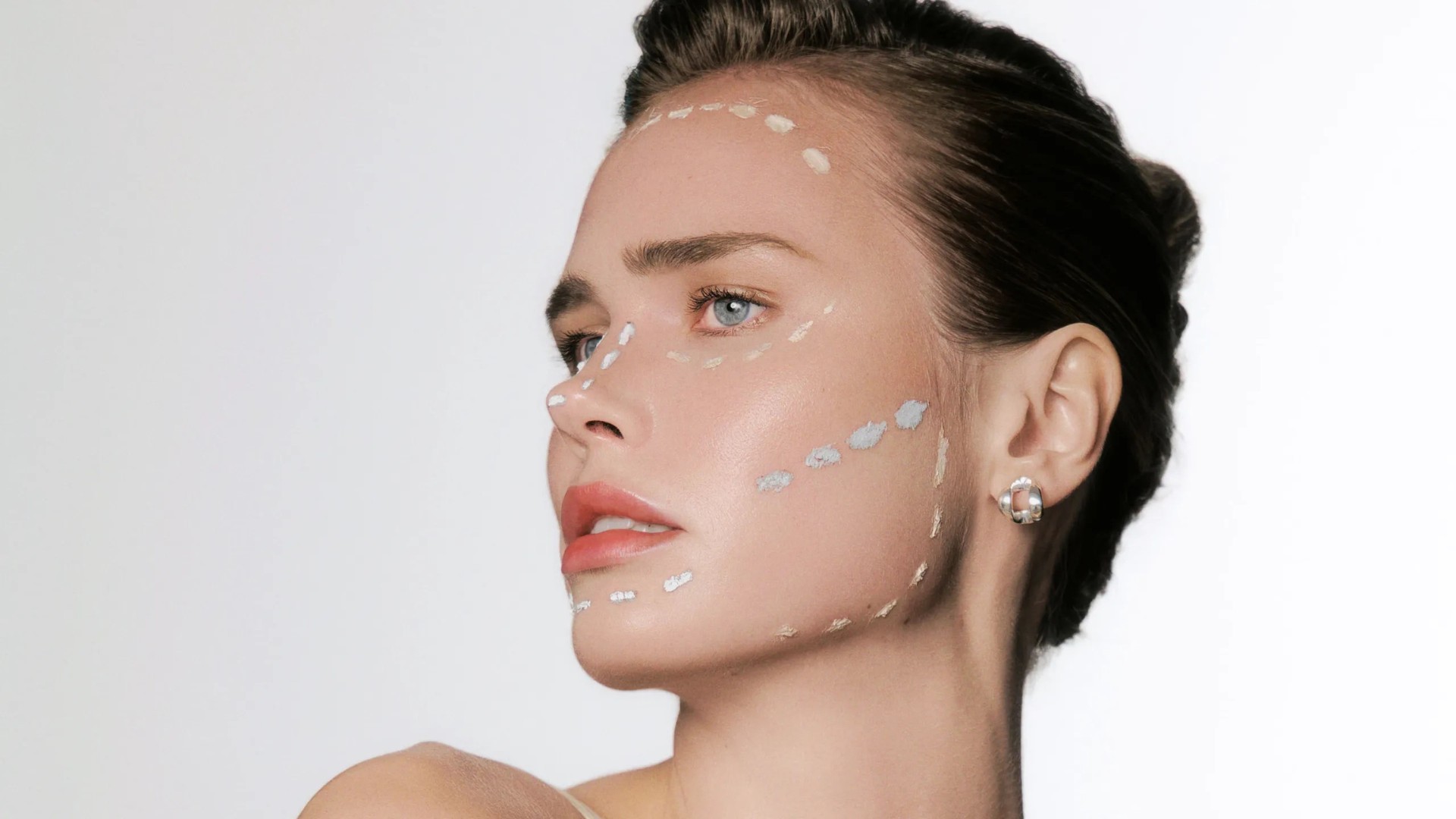 Nâng cơ mặt là gì?