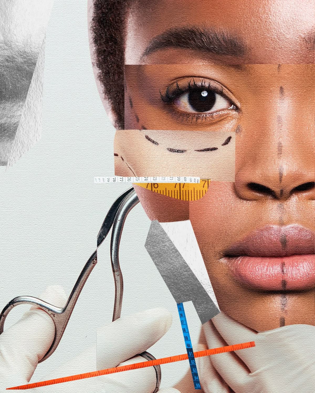 Phẫu thuật căng da mặt