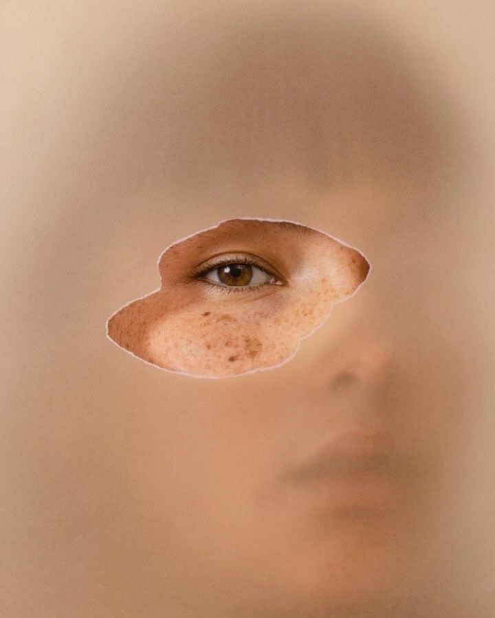 Hinh anh Melasyl: Hoạt chất quan trọng trong các sản phẩm điều trị thâm nám 1