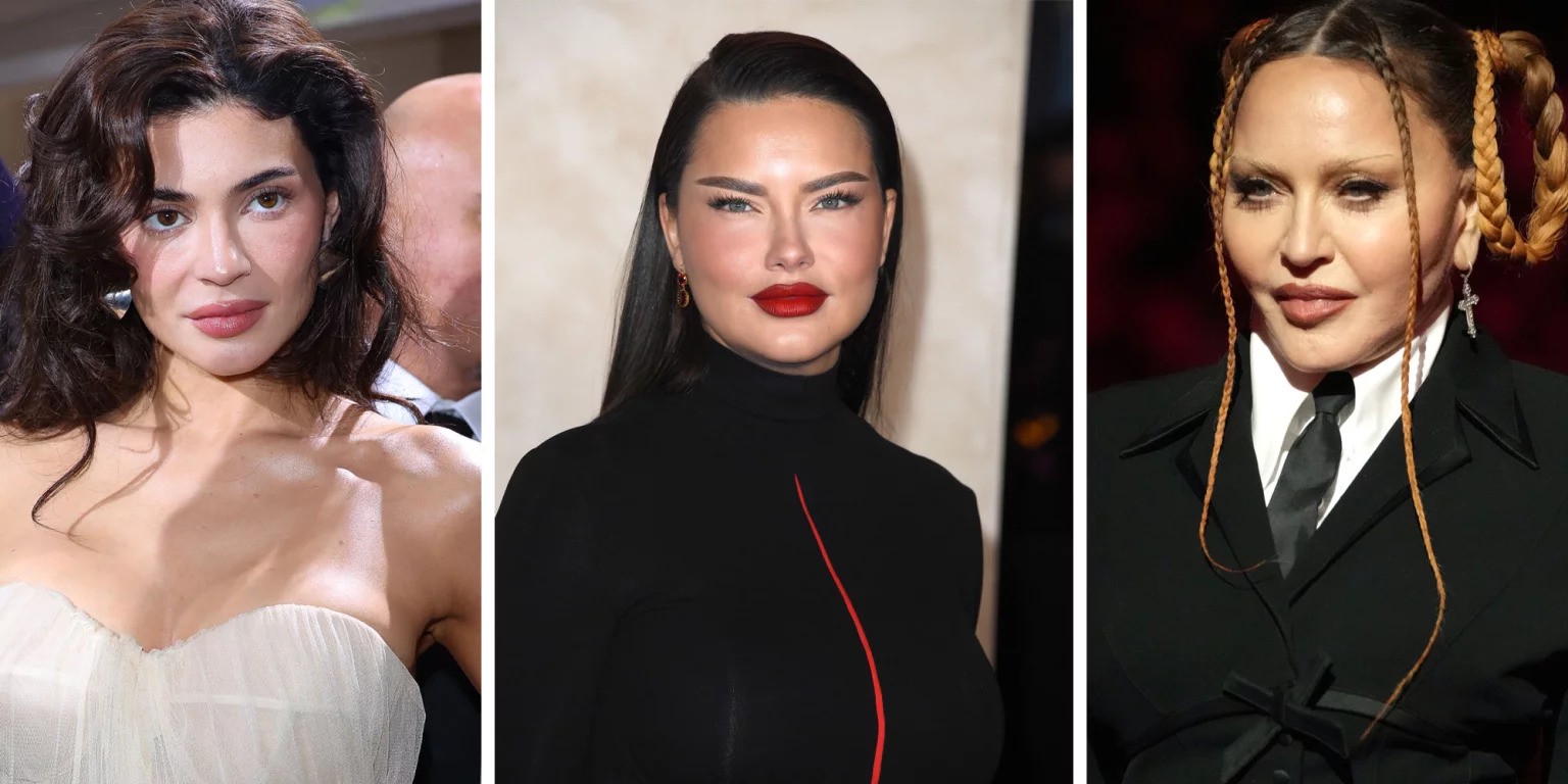 Hinh anh Pillow Face: Hệ quả thẩm mỹ của việc lạm dụng filler 1