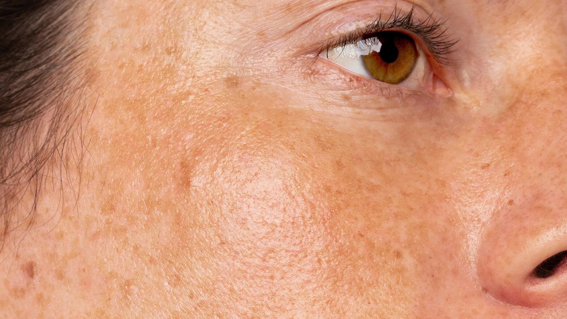 Hinh anh Skin Density: Thước đo mới của làn da đẹp 1